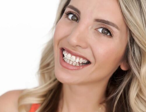Reasons for Teeth Shifting and Solutions